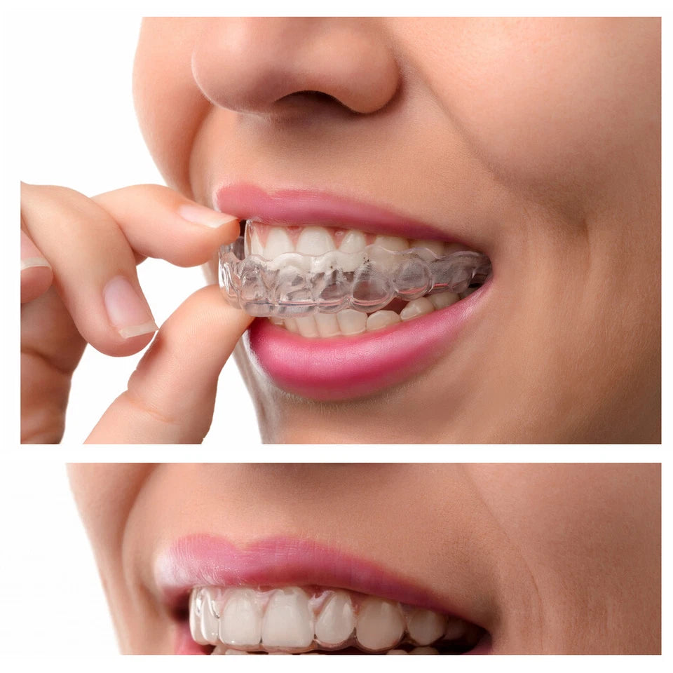 Teeth Grinding Mouth Guard Night Bruxism Clenching Tooth